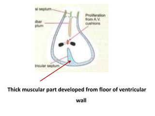 Thick muscular part developed from floor of ventricular
wall
 
