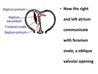 • Now the right
and left atrium
communicate
with foramen
ovale, a oblique
valvular opening
 