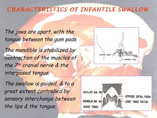 CHARACTERISTICS OF INFANTILE SWALLOW

The jaws are apart, with the
tongue between the gum pads
The mandible is stabilized ...