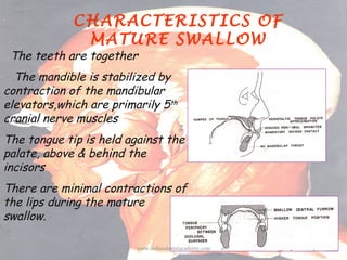 CHARACTERISTICS OF
MATURE SWALLOW

The teeth are together

The mandible is stabilized by
contraction of the mandibular
ele...