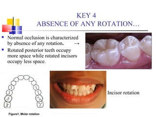 Development of dentition and occlusion | PPT