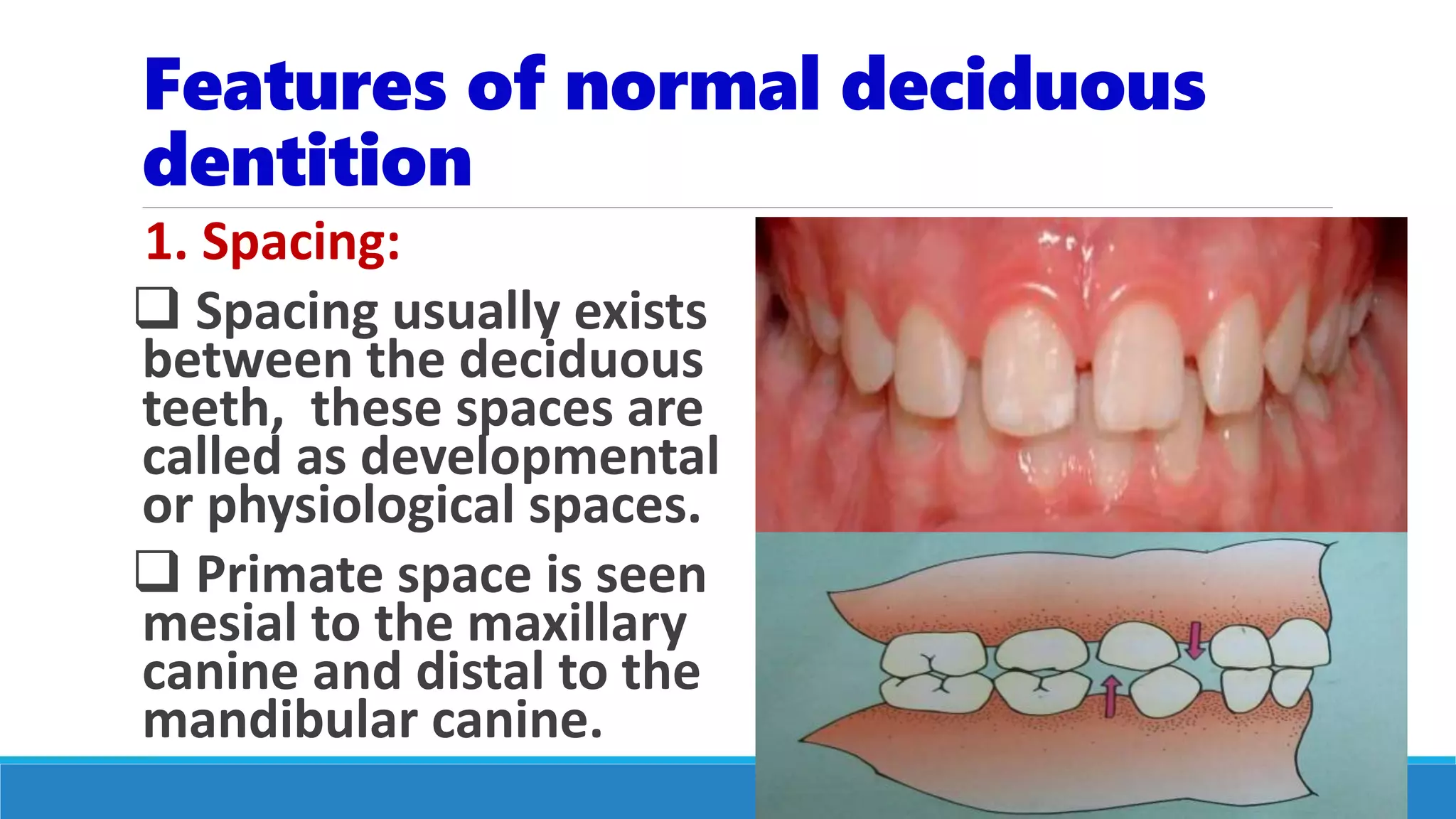 Features of normal deciduous
dentition
1. Spacing:
 Spacing usually exists
between the deciduous
teeth, these spaces are
called as developmental
or physiological spaces.
 Primate space is seen
mesial to the maxillary
canine and distal to the
mandibular canine.
 