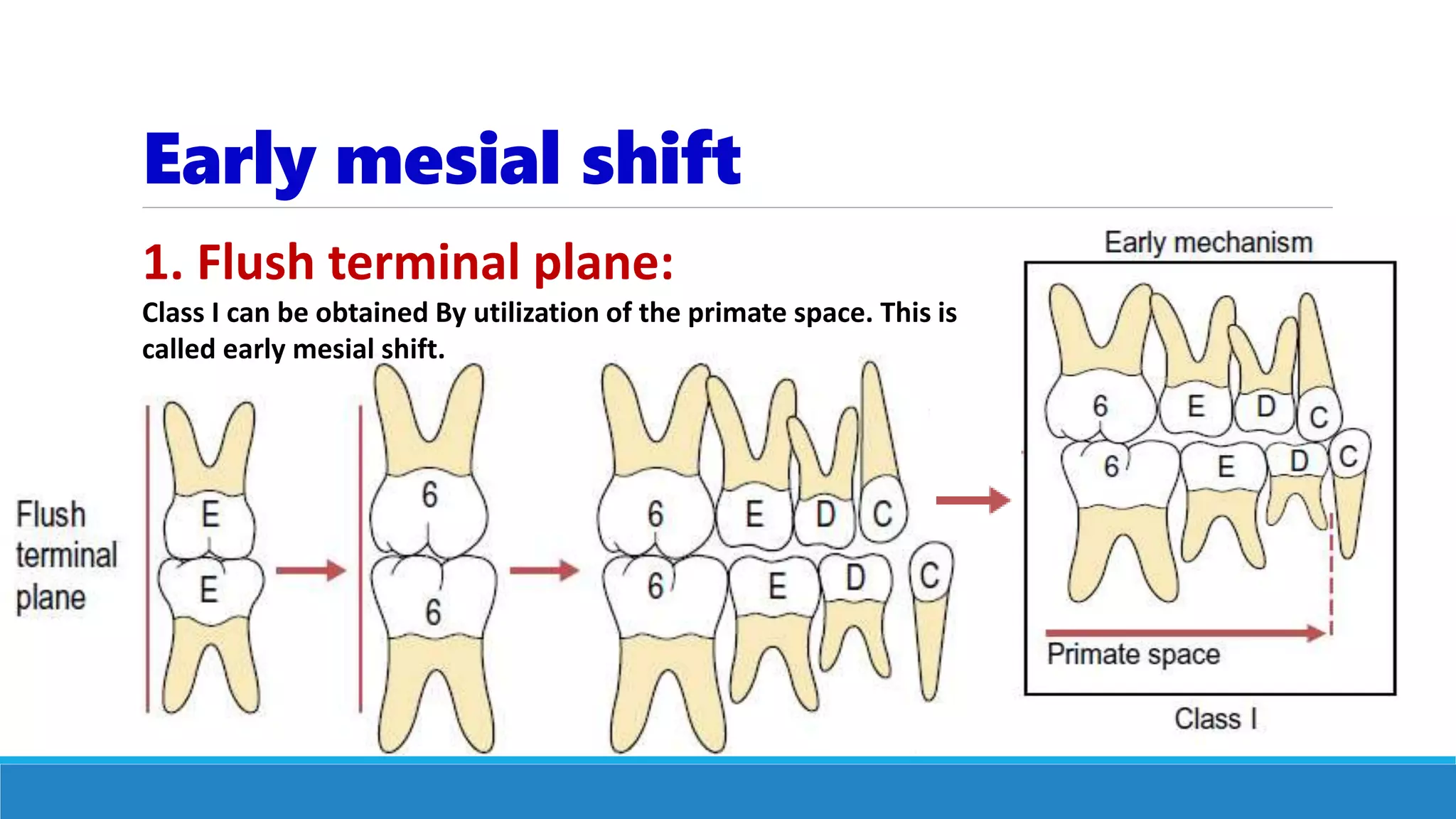 Early mesial shift
1. Flush terminal plane:
Class I can be obtained By utilization of the primate space. This is
called early mesial shift.
 