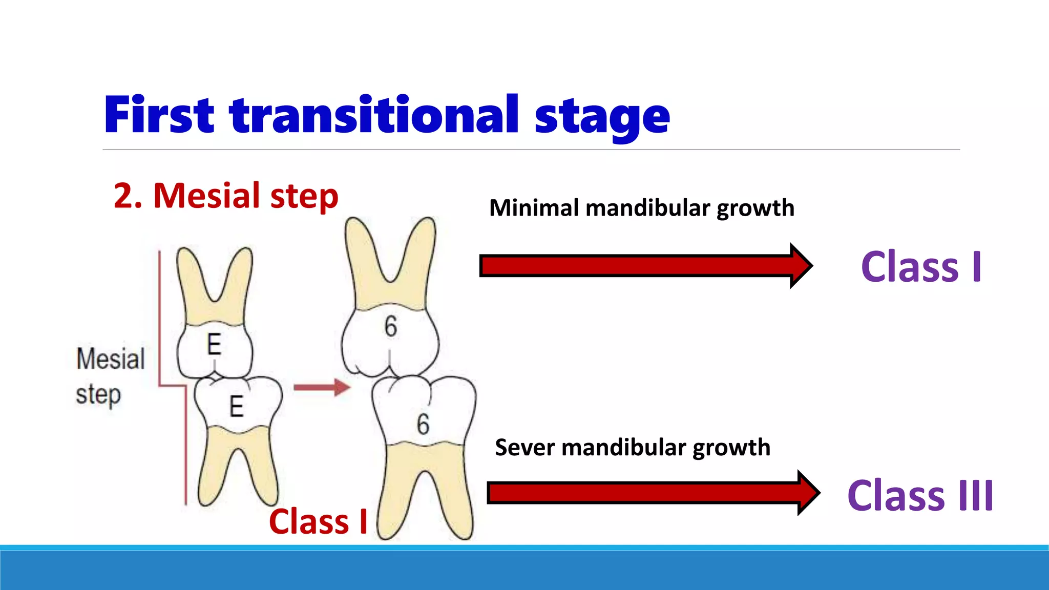 First transitional stage
Class I
Class IIIClass I
Minimal mandibular growth
Sever mandibular growth
2. Mesial step
 