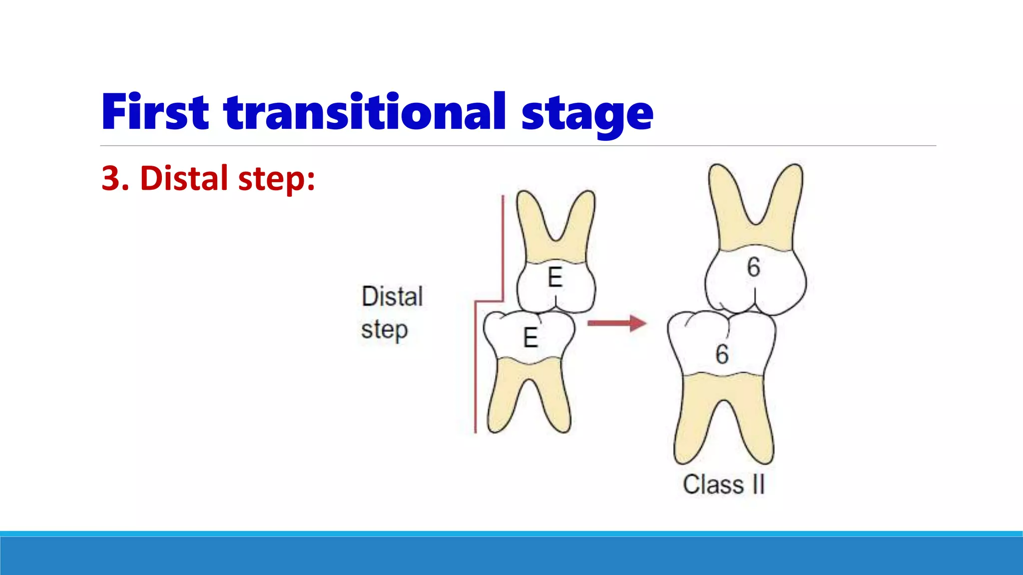 First transitional stage
3. Distal step:
 