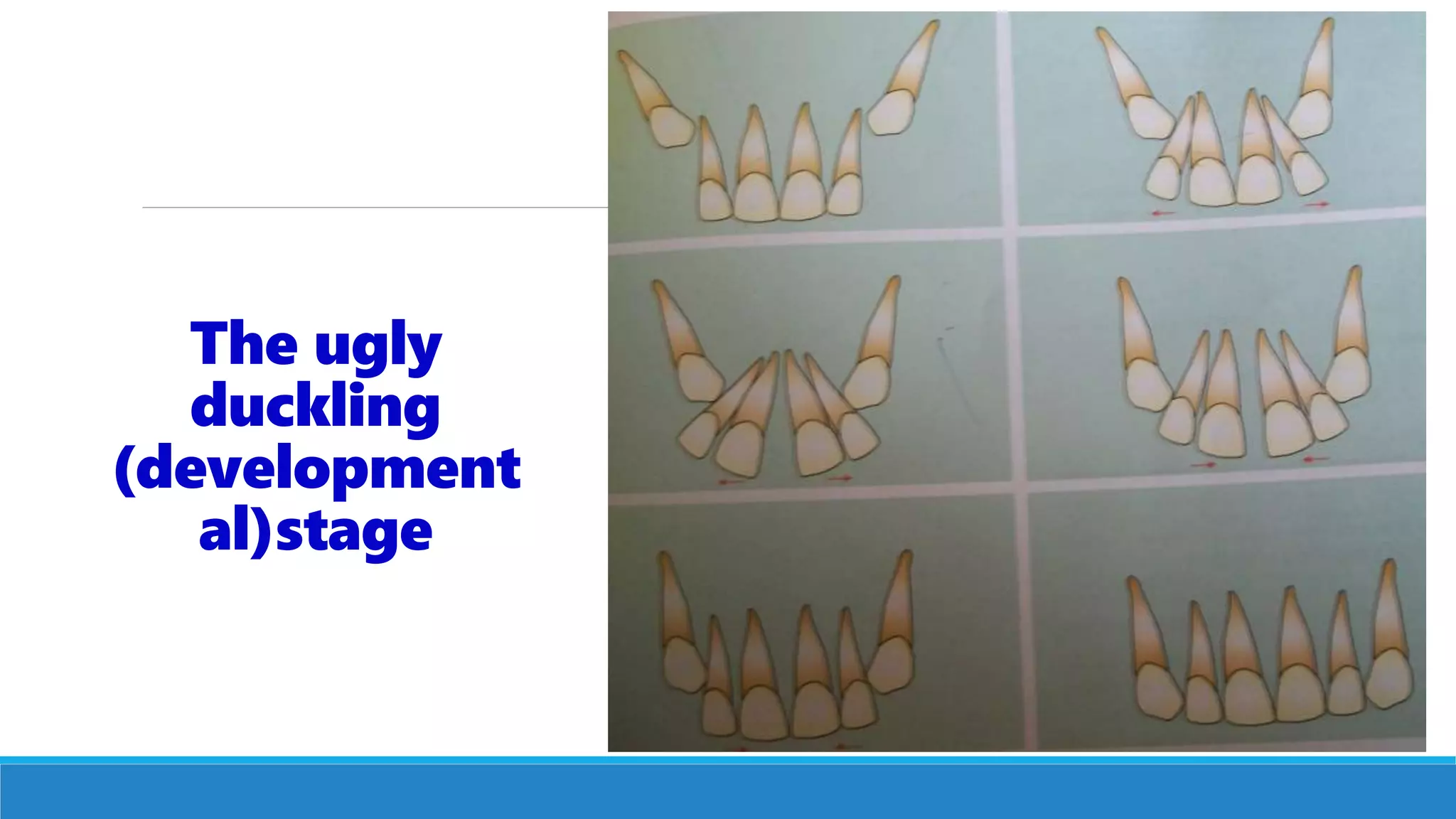 The ugly
duckling
(development
al)stage
 