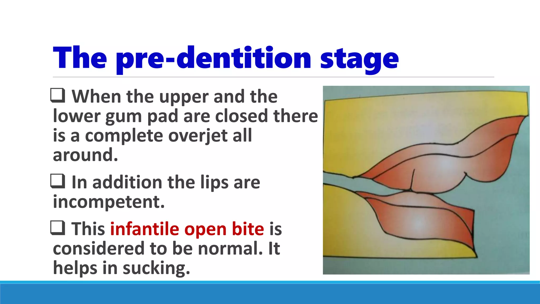 The pre-dentition stage
 When the upper and the
lower gum pad are closed there
is a complete overjet all
around.
 In addition the lips are
incompetent.
 This infantile open bite is
considered to be normal. It
helps in sucking.
 