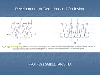 Development of Dentition and Occlusion
PROF (Dr.) SAIBEL FARISHTA
 