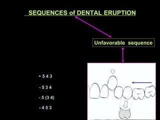 SEQUENCES of DENTAL ERUPTION



                       Unfavorable sequence


SECOND MOLARS

   erupting before

 Second p...