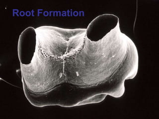 Root Formation
 