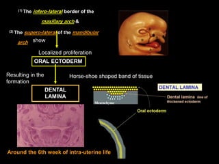 (1) The   infero-lateral border of the
                  maxillary arch &
 (2) The   supero-lateral of the mandibular
    ...