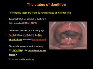 The deciduous dentition period
 