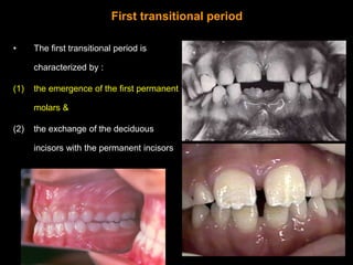 Emergence of the first permanent molars:


•   The mandibular first molar is the first permanent tooth to erupt at around ...