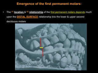 Emergence of the first permanent molars:

•   The first permanent molars are Guided into the dental arch by distal surface...