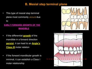 B. Mesial step terminal plane

•    This type of mesial step terminal
     plane most commonly occurs due
     to
    EARL...