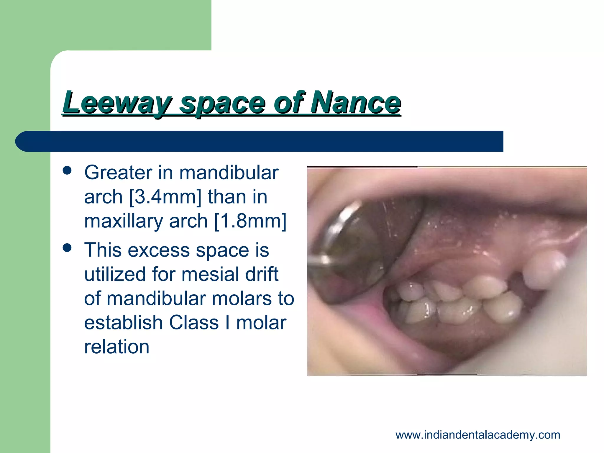 Leeway space of Nance




Greater in mandibular
arch [3.4mm] than in
maxillary arch [1.8mm]
This excess space is
utilized for mesial drift
of mandibular molars to
establish Class I molar
relation

www.indiandentalacademy.com

 