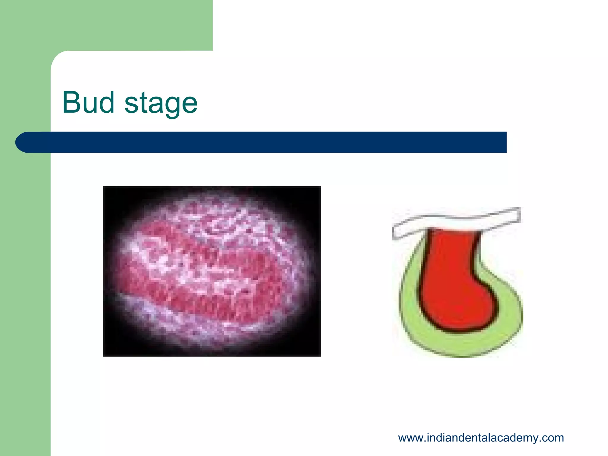 Bud stage

www.indiandentalacademy.com

 