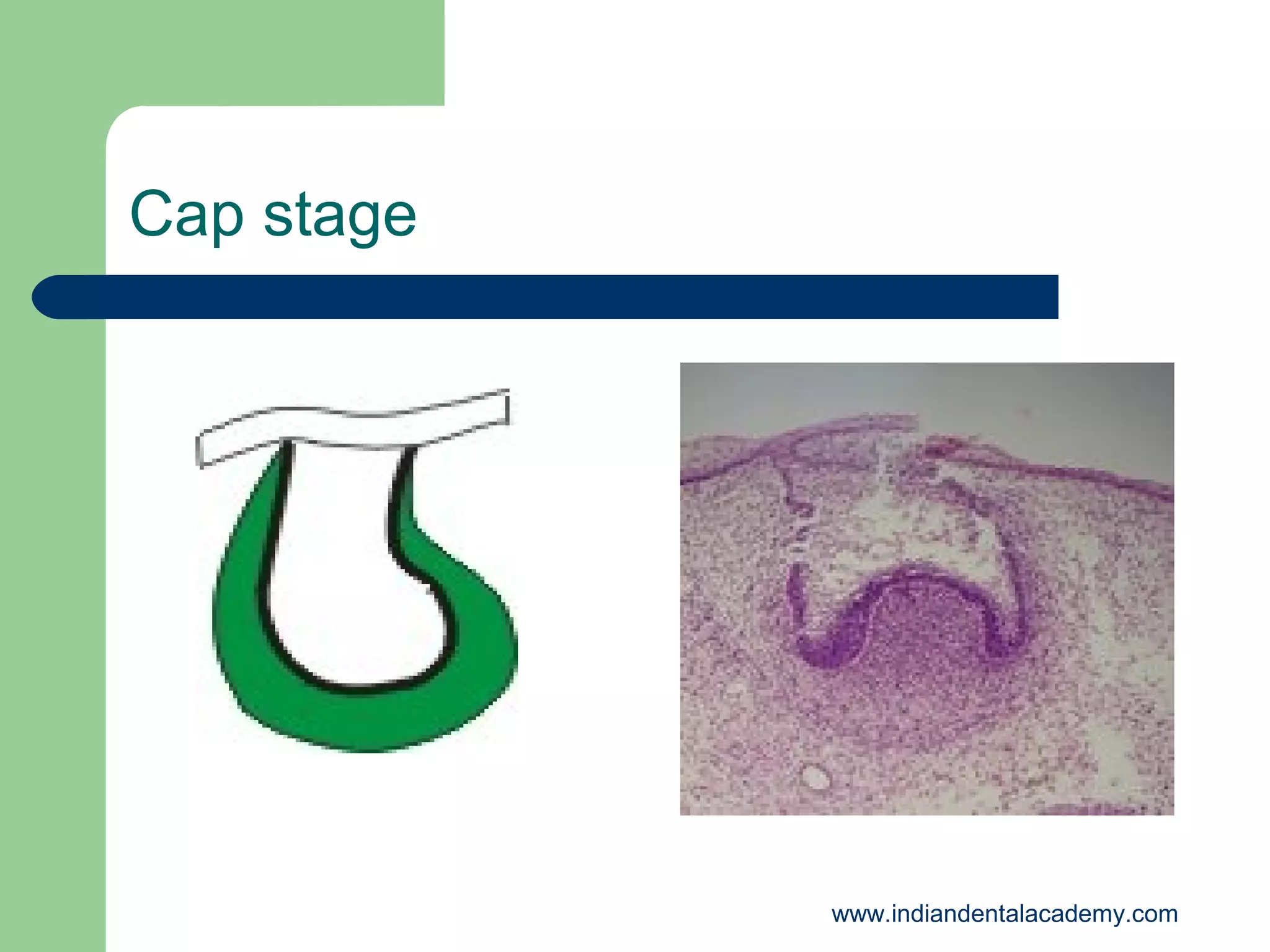 Cap stage

www.indiandentalacademy.com

 