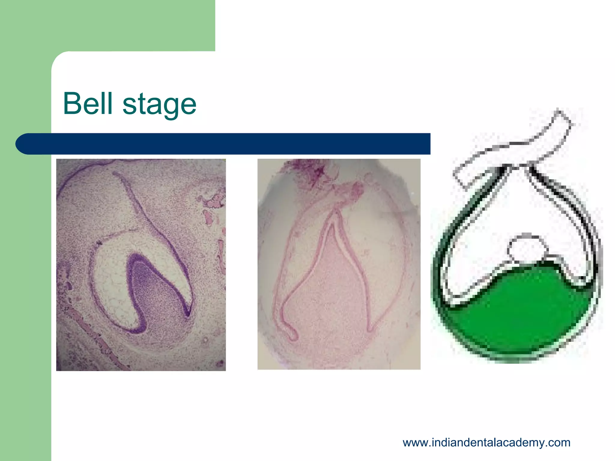 Bell stage

www.indiandentalacademy.com

 