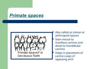 DEVELOPMENT OF DENTITION & OCCLUSION. Spacing in mixed Dentition.ppt
