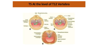 TS At the level of T12 Vertebra
 