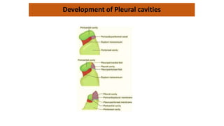 Development of Pleural cavities
 