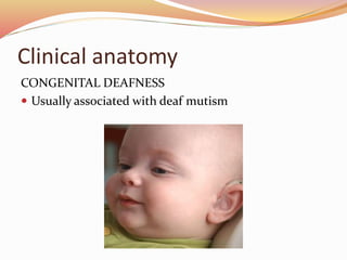 Clinical anatomy
CONGENITAL DEAFNESS
 Usually associated with deaf mutism
 