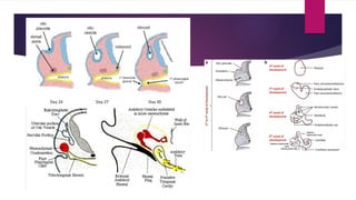 Development_of_Ear slide and congenital disease of external ear | PPTX