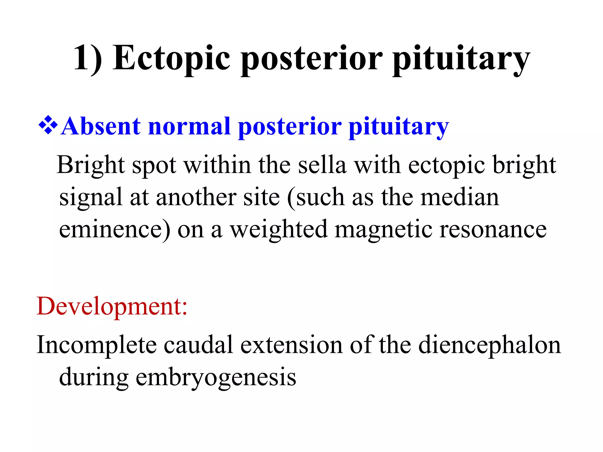 1) Ectopic posterior pituitary
Absent normal posterior pituitary
Bright spot within the sella with ectopic bright
signal at another site (such as the median
eminence) on a weighted magnetic resonance
Development:
Incomplete caudal extension of the diencephalon
during embryogenesis
 
