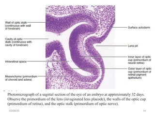 Eye Embryo Development Embryological Development of eye eye.ppt