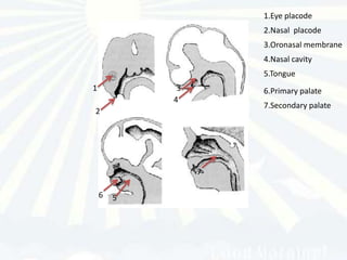 1.Eye placode
                     2.Nasal placode
                     3.Oronasal membrane
                     4.Nasal cavity
                     5.Tongue
1            3       6.Primary palate
            4
                     7.Secondary palate
2




                 7

    6   5
 