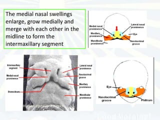 The medial nasal swellings
enlarge, grow medially and
merge with each other in the
midline to form the
intermaxillary segment




      Human embryo: 7 weeks
 