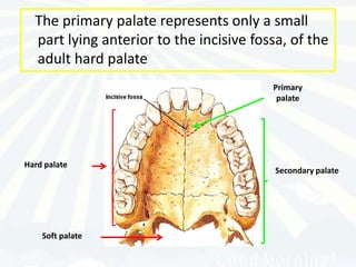 The primary palate represents only a small
  part lying anterior to the incisive fossa, of the
  adult hard palate
                                         Primary
                                          palate




Hard palate
                                          Secondary palate




    Soft palate
 