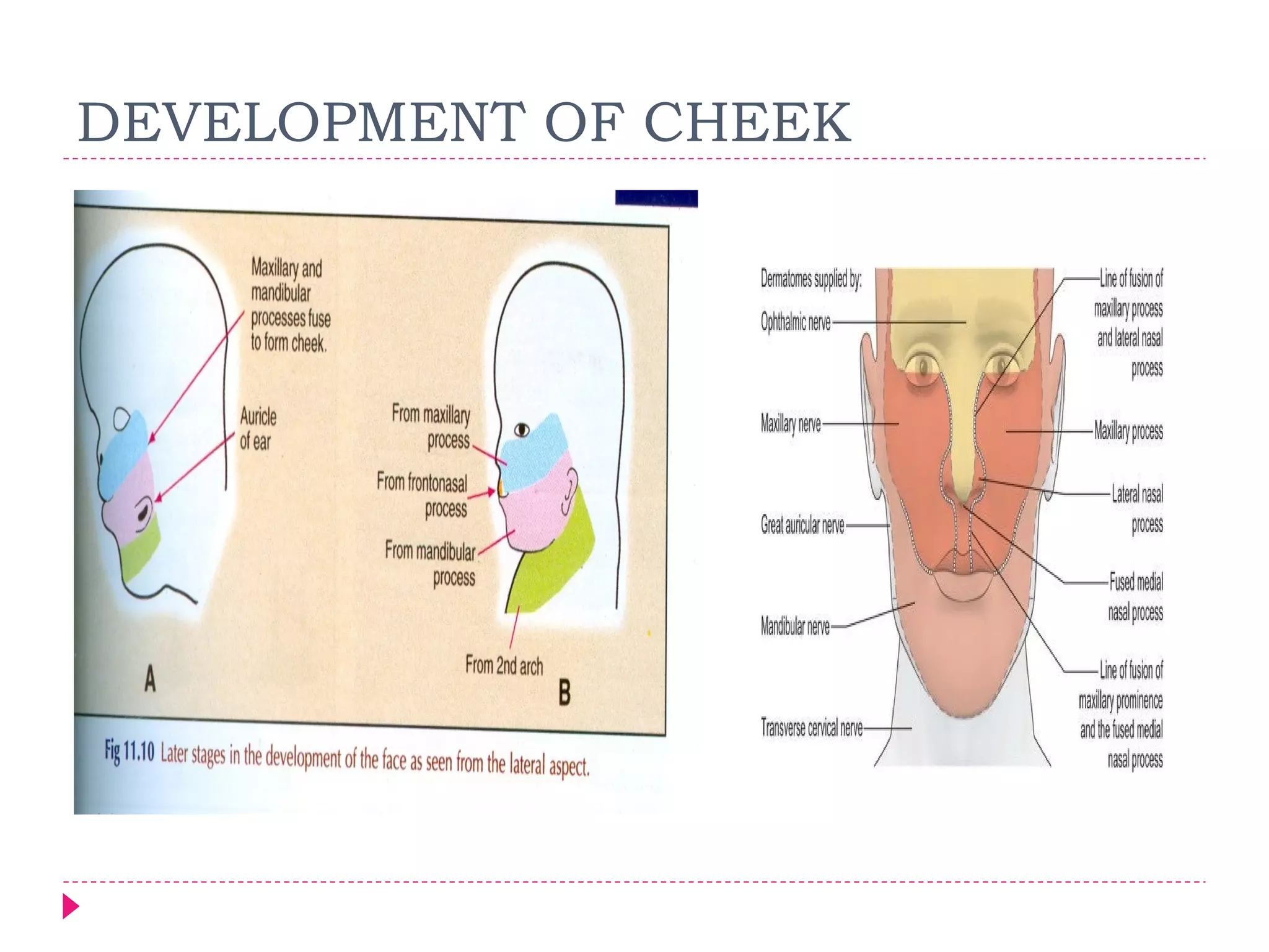 DEVELOPMENT OF CHEEK

 