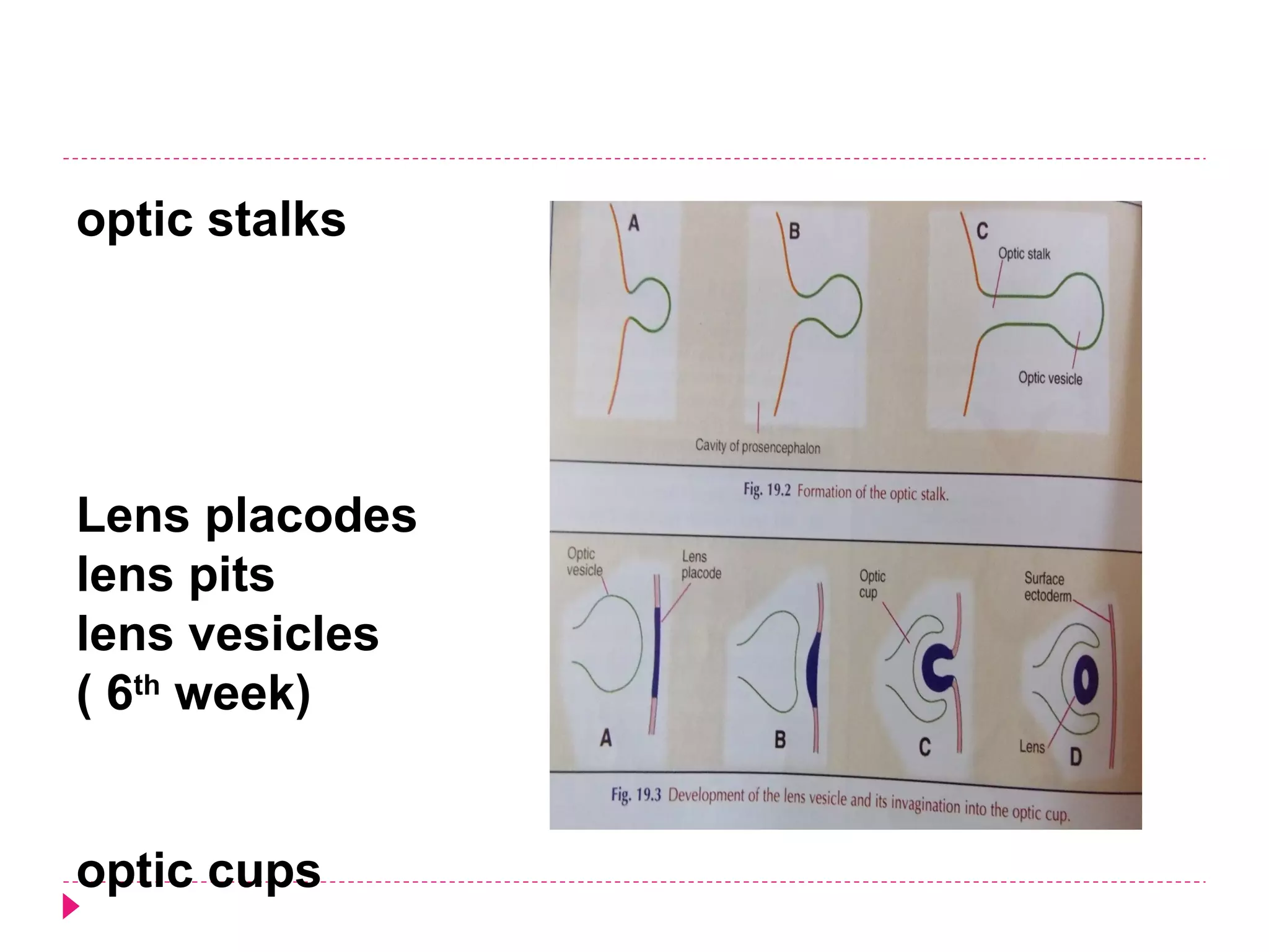 optic stalks

Lens placodes
lens pits
lens vesicles
( 6th week)
optic cups

 