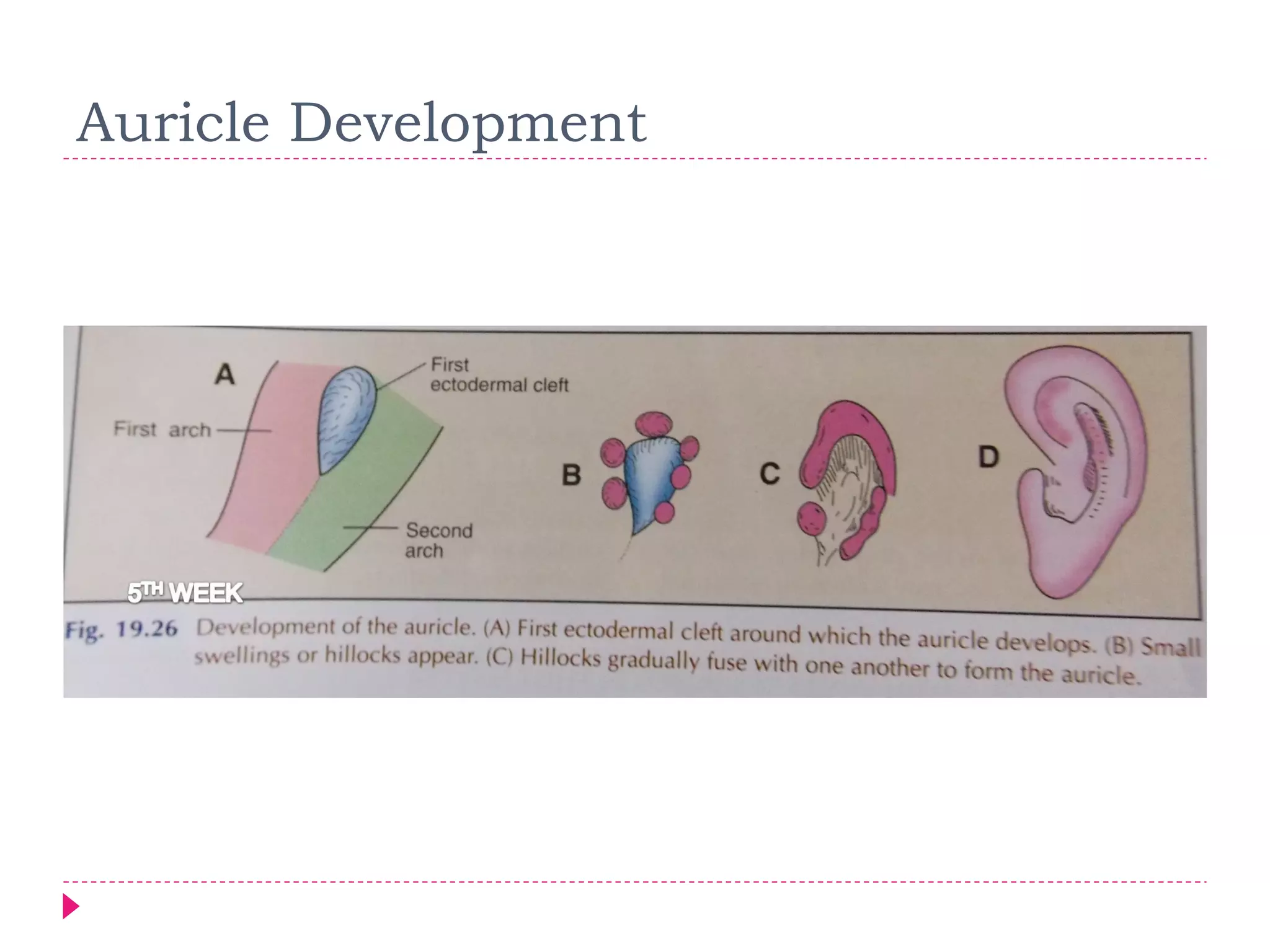 Auricle Development

 