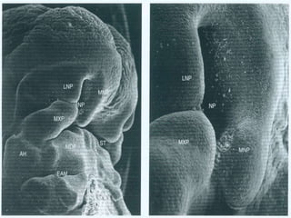Development of face | PPTX