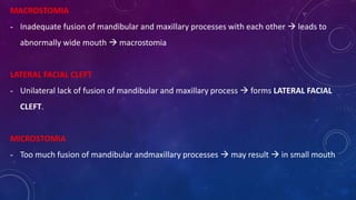 MACROSTOMIA
- Inadequate fusion of mandibular and maxillary processes with each other  leads to
abnormally wide mouth  macrostomia
LATERAL FACIAL CLEFT
- Unilateral lack of fusion of mandibular and maxillary process  forms LATERAL FACIAL
CLEFT.
MICROSTOMIA
- Too much fusion of mandibular andmaxillary processes  may result  in small mouth
 