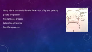 - Now, all the primordial for the formation of lip and primary
palate are present
- Medial nasal process
- Lateral nasal formed
- Maxillary process
 