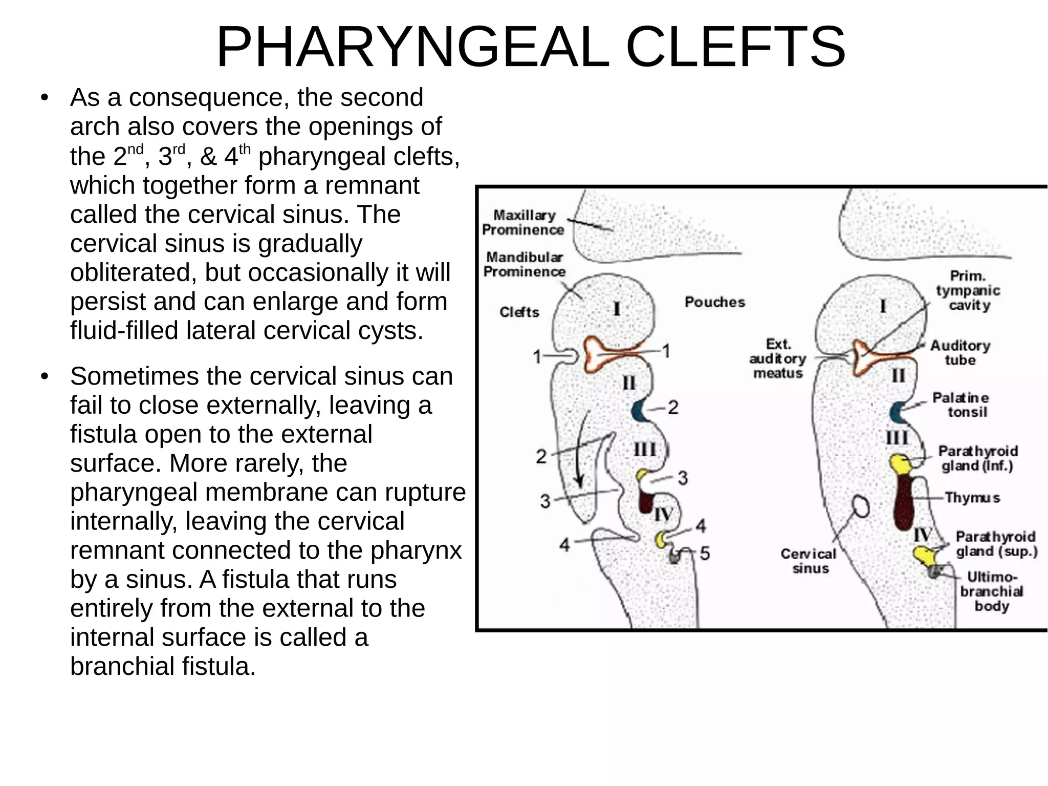 ● As a consequence, the second
arch also covers the openings of
the 2nd
, 3rd
, & 4th
pharyngeal clefts,
which together form a remnant
called the cervical sinus. The
cervical sinus is gradually
obliterated, but occasionally it will
persist and can enlarge and form
fluid-filled lateral cervical cysts.
● Sometimes the cervical sinus can
fail to close externally, leaving a
fistula open to the external
surface. More rarely, the
pharyngeal membrane can rupture
internally, leaving the cervical
remnant connected to the pharynx
by a sinus. A fistula that runs
entirely from the external to the
internal surface is called a
branchial fistula.
PHARYNGEAL CLEFTS
 