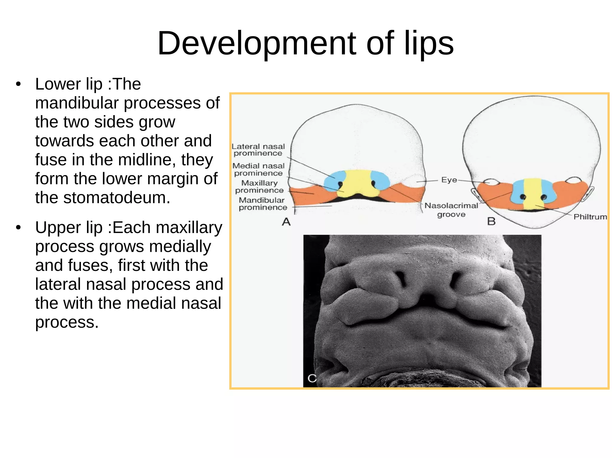 Development of lips
● Lower lip :The
mandibular processes of
the two sides grow
towards each other and
fuse in the midline, they
form the lower margin of
the stomatodeum.
● Upper lip :Each maxillary
process grows medially
and fuses, first with the
lateral nasal process and
the with the medial nasal
process.
 