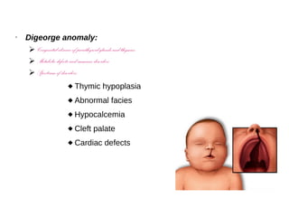 • Digeorge anomaly:
➢ Congenital absence of parathyroid glands and thymus
➢ Metabolic defects and immune disorders
➢ Spectrum of disorders:
 Thymic hypoplasia
 Abnormal facies
 Hypocalcemia
 Cleft palate
 Cardiac defects
 