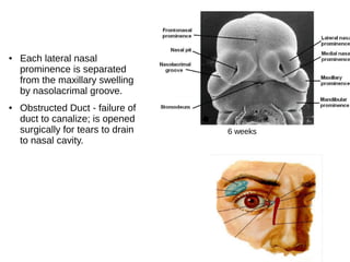 ● Each lateral nasal
prominence is separated
from the maxillary swelling
by nasolacrimal groove.
● Obstructed Duct - failure of
duct to canalize; is opened
surgically for tears to drain
to nasal cavity.
6 weeks
 