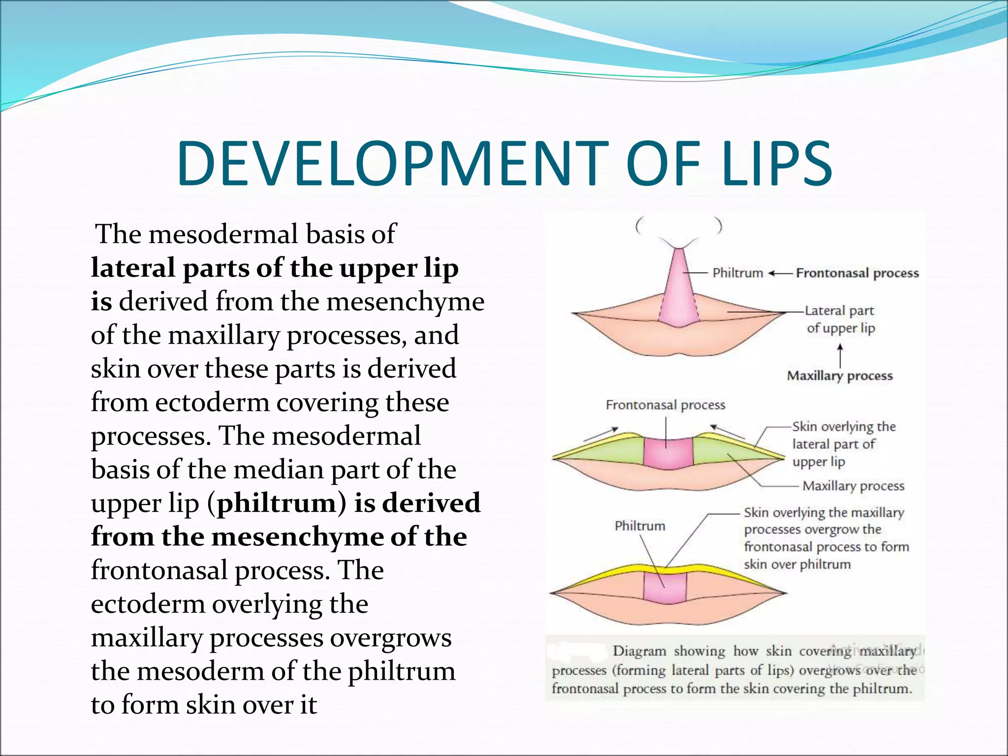 DEVELOPMENT OF LIPS
The mesodermal basis of
lateral parts of the upper lip
is derived from the mesenchyme
of the maxillary processes, and
skin over these parts is derived
from ectoderm covering these
processes. The mesodermal
basis of the median part of the
upper lip (philtrum) is derived
from the mesenchyme of the
frontonasal process. The
ectoderm overlying the
maxillary processes overgrows
the mesoderm of the philtrum
to form skin over it
 
