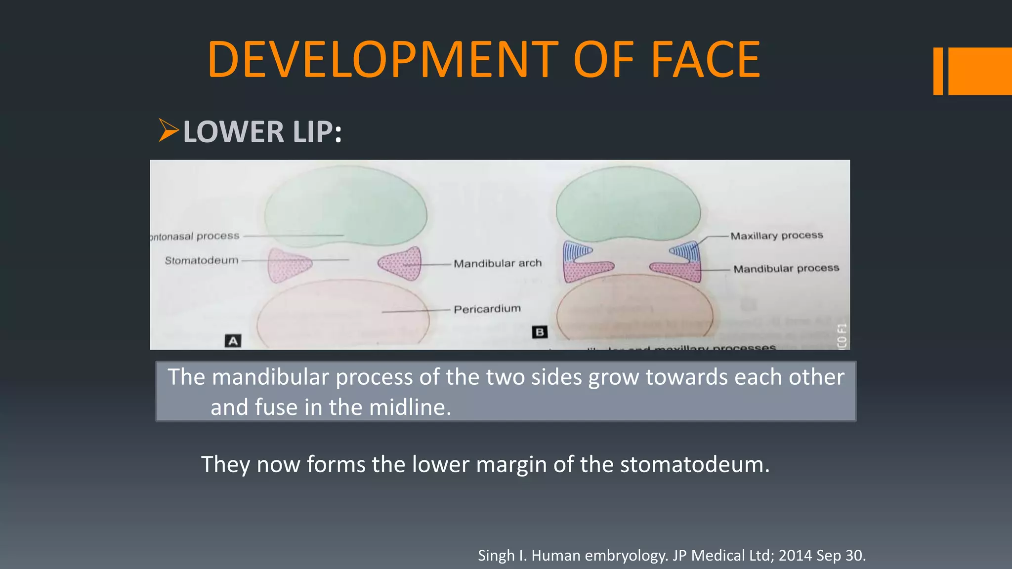 DEVELOPMENT OF FACE
LOWER LIP:
They now forms the lower margin of the stomatodeum.
The mandibular process of the two sides grow towards each other
and fuse in the midline.
Singh I. Human embryology. JP Medical Ltd; 2014 Sep 30.
 