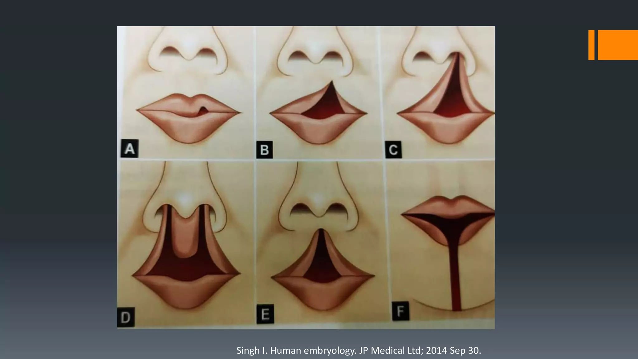 Singh I. Human embryology. JP Medical Ltd; 2014 Sep 30.
 