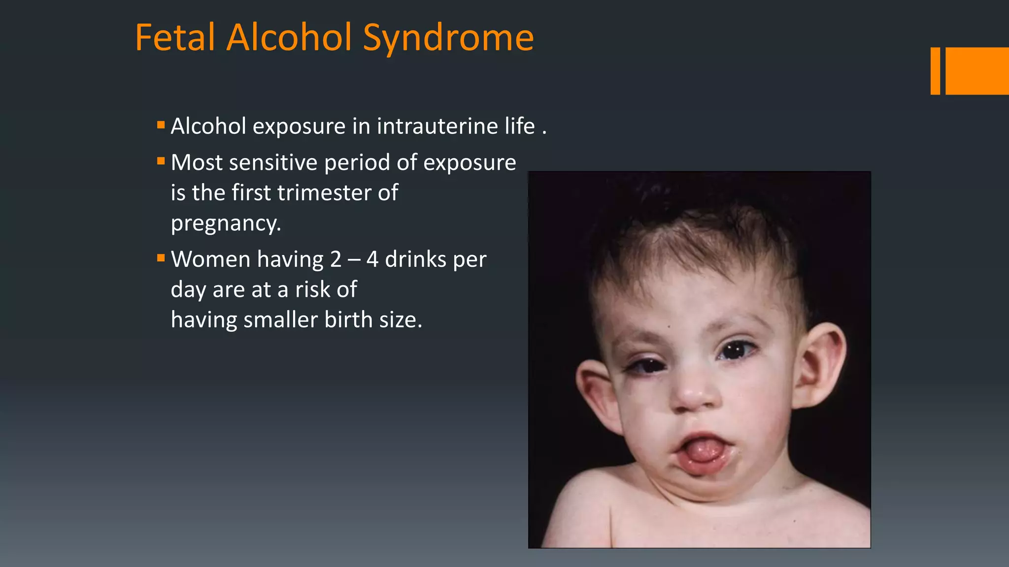 Fetal Alcohol Syndrome
Alcohol exposure in intrauterine life .
Most sensitive period of exposure
is the first trimester of
pregnancy.
Women having 2 – 4 drinks per
day are at a risk of
having smaller birth size.
 