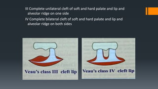 Development of face and palate | PPTX