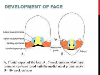 Development of face, nose, palate by dr. noura 2014 | PDF