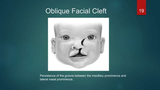 Normal Face Part One Development of Face Part 1 | PPTX